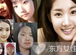 朴敏英整容前照片